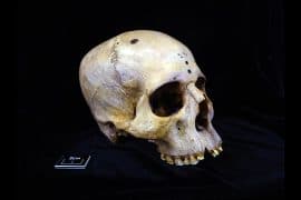 2024/06/ancient-egyptian-skull_4000-years-old_cancer-surgery_credit-Tondini_1m.jpg