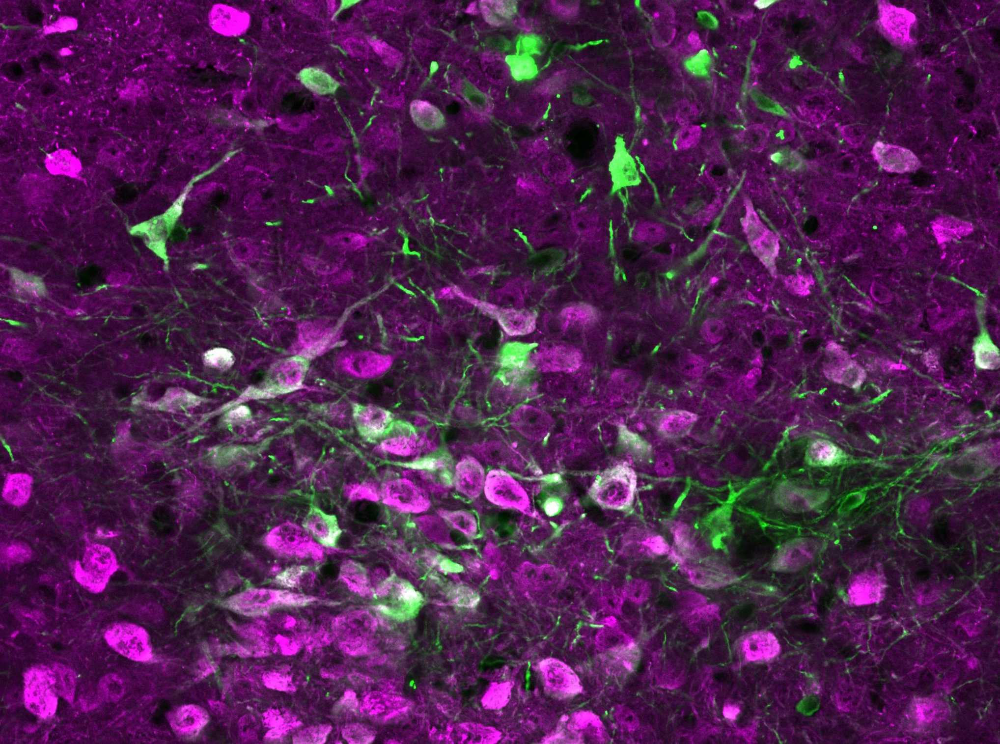 Serotonin found to expedite the learning process