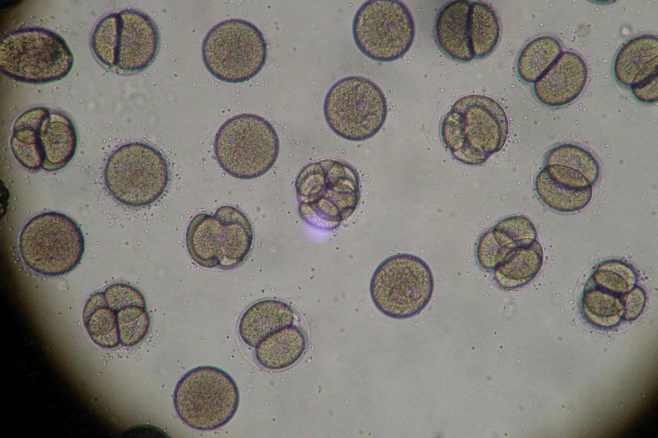 How Are Plant Cells Different Than Fungi Cells?
