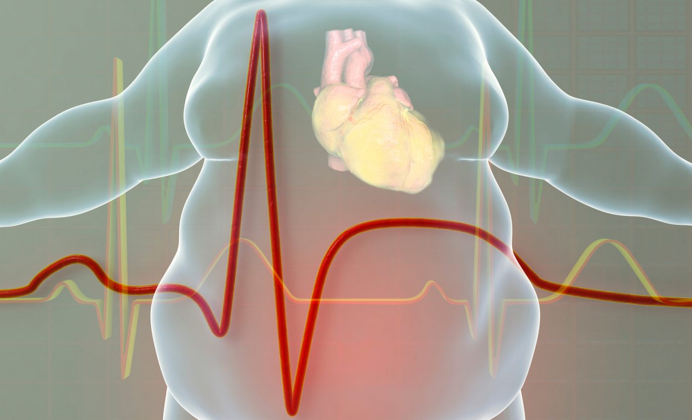 Nine U.S. states now have an obesity rate of at least 35 percent
