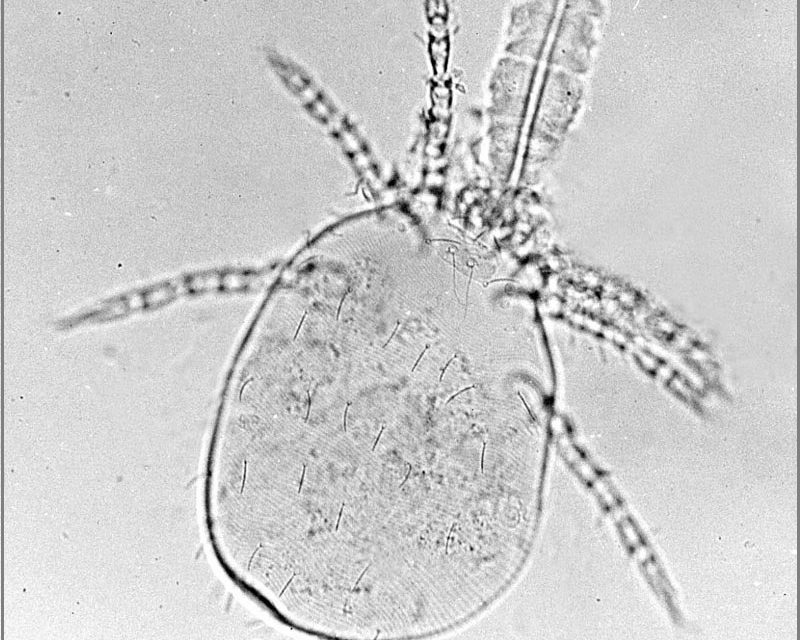 Ouch! What Is a Chigger and Where Do They Live?