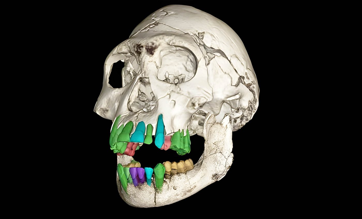 Fossil teeth show why humans evolved big brains and long childhoods