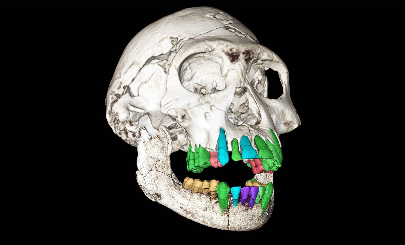 Fossil teeth from an 11-year-old reveal clues to why human childhood lasts so long